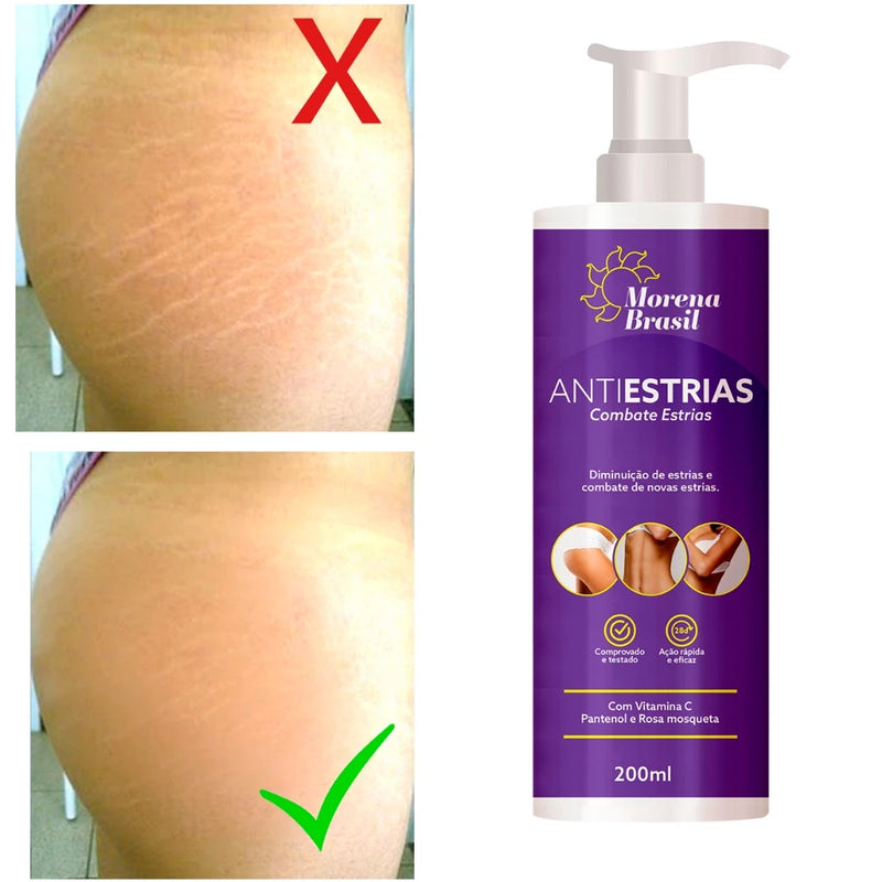 Creme AntiEstrias Removedor Estrias 200g Morena Brasil – Ação Poderosa com Colágeno e Elastina