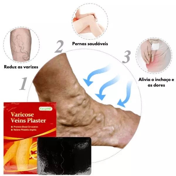 Kit Adesivos Auxilia As Varizes, Vasos E Veias Diminuição - mimarte