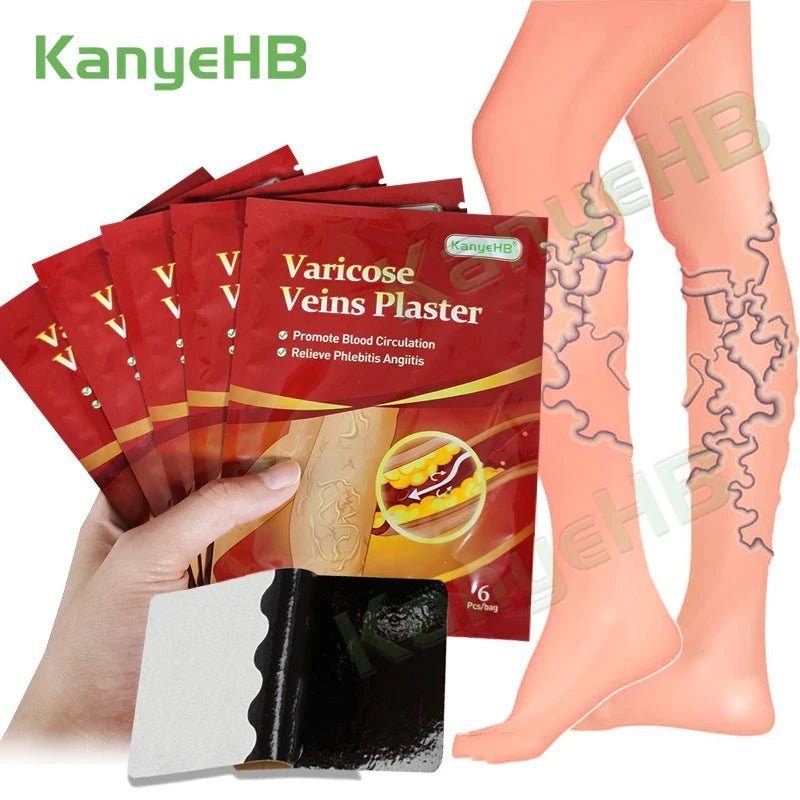 Kit Adesivos Auxilia As Varizes, Vasos E Veias Diminuição - mimarte