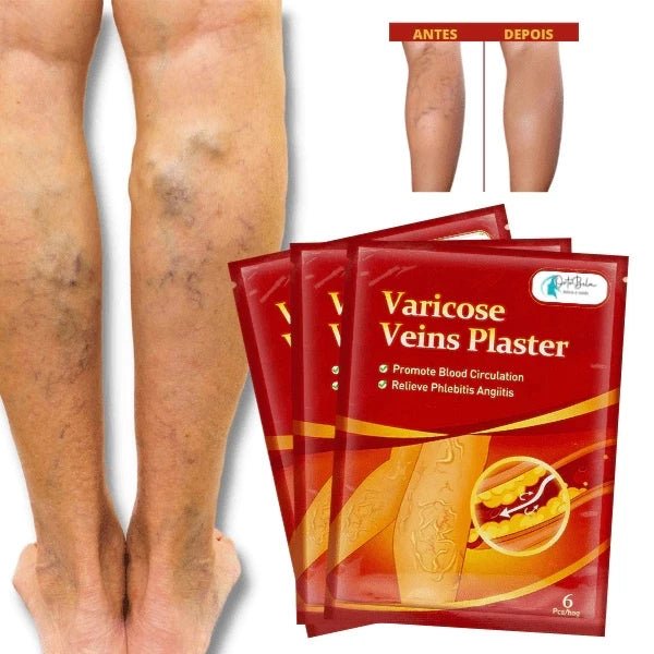 Kit Adesivos Auxilia As Varizes, Vasos E Veias Diminuição - mimarte