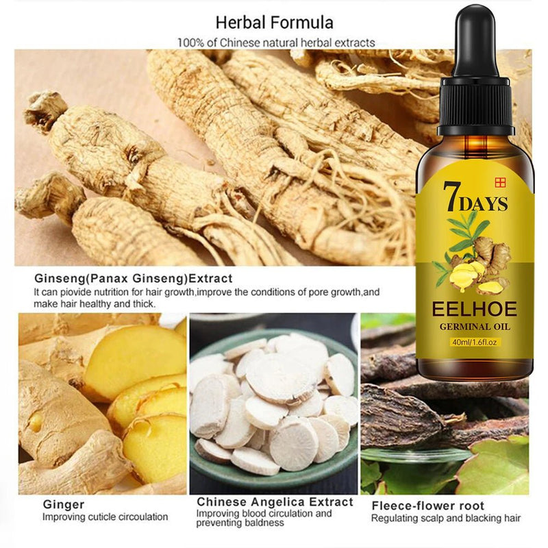 Sérum de crescimento capilar Óleo essencial para crescimento rápido de cabelos Beleza Cuidados com os cabelos 10/20/40ml Denso Recrescimento Gengibre Cabelo Promovendo Regeneração - mimarte